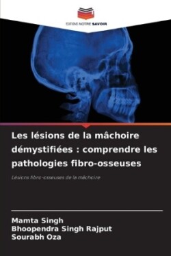 Les lésions de la mâchoire démystifiées