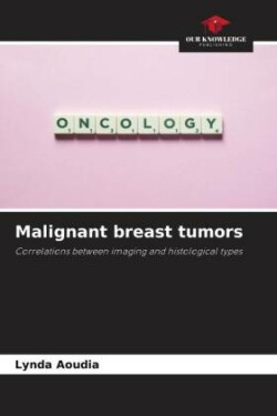 Malignant breast tumors