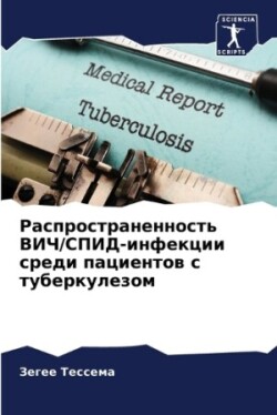 Распространенность ВИЧ/СПИД-инфекции сре