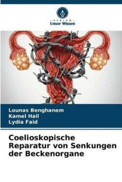 Coelioskopische Reparatur von Senkungen der Beckenorgane