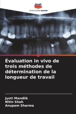 Évaluation in vivo de trois méthodes de détermination de la longueur de travail