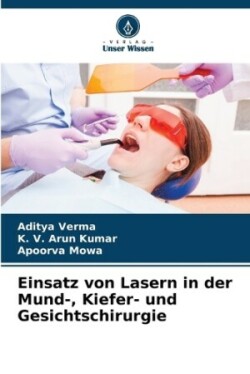 Einsatz von Lasern in der Mund-, Kiefer- und Gesichtschirurgie