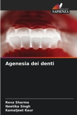 Agenesia dei denti