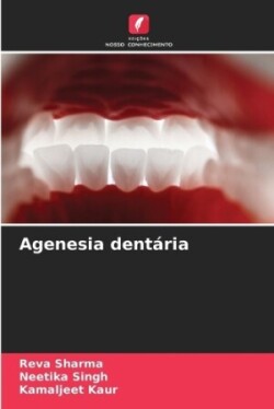 Agenesia dentária