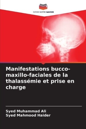 Manifestations bucco-maxillo-faciales de la thalassémie et prise en charge