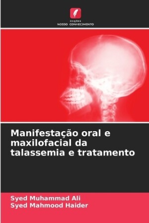 Manifestação oral e maxilofacial da talassemia e tratamento