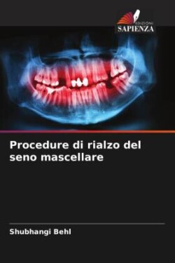 Procedure di rialzo del seno mascellare