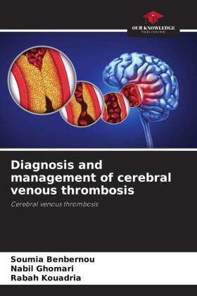 Diagnosis and management of cerebral venous thrombosis