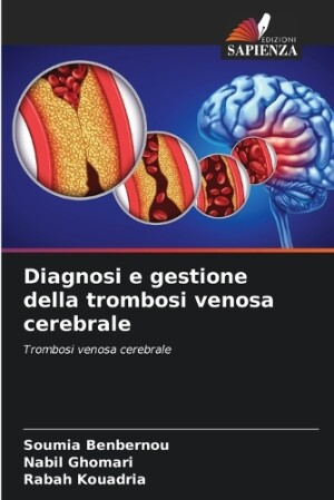 Diagnosi e gestione della trombosi venosa cerebrale