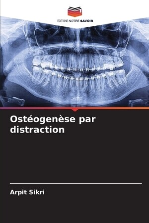 Ostéogenèse par distraction