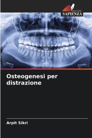 Osteogenesi per distrazione