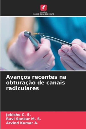 Avanços recentes na obturação de canais radiculares