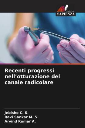 Recenti progressi nell'otturazione del canale radicolare