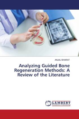 Analyzing Guided Bone Regeneration Methods: A Review of the Literature