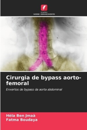 Cirurgia de bypass aorto-femoral