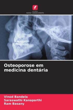 Osteoporose em medicina dentária