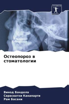 Osteoporoz w stomatologii