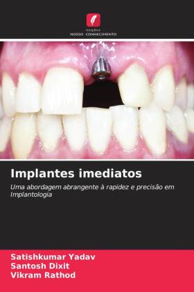 Implantes imediatos