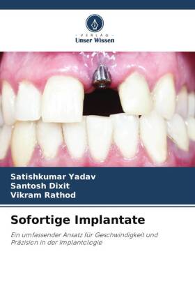 Sofortige Implantate