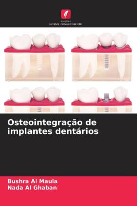 Osteointegração de implantes dentários