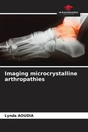 Imaging microcrystalline arthropathies