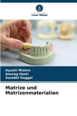 Matrize und Matrizenmaterialien