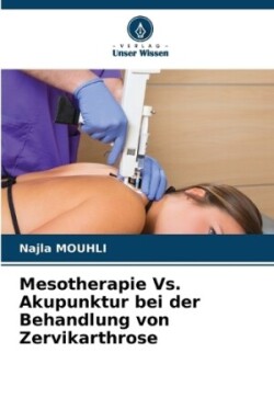 Mesotherapie Vs. Akupunktur bei der Behandlung von Zervikarthrose