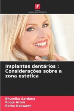 Implantes dentários