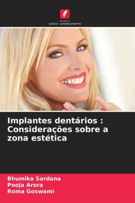 Implantes dentários : Considerações sobre a zona estética