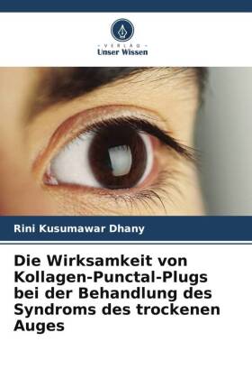 Die Wirksamkeit von Kollagen-Punctal-Plugs bei der Behandlung des Syndroms des trockenen Auges