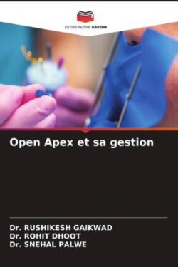 Open Apex et sa gestion