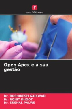 Open Apex e a sua gestão