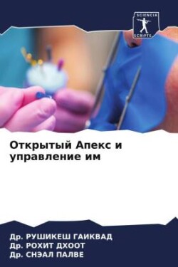 Otkrytyj Apex i uprawlenie im