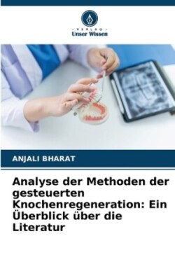 Analyse der Methoden der gesteuerten Knochenregeneration