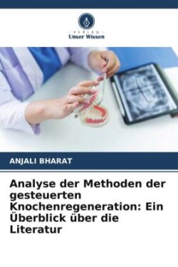 Analyse der Methoden der gesteuerten Knochenregeneration: Ein Überblick über die Literatur