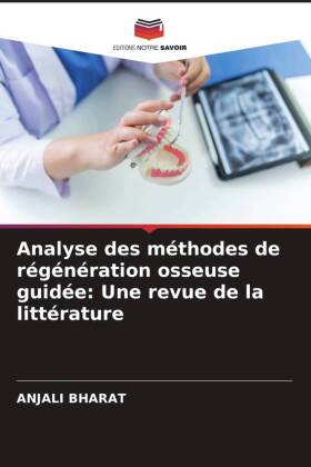 Analyse des méthodes de régénération osseuse guidée: Une revue de la littérature