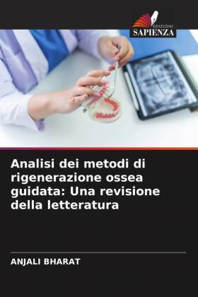 Analisi dei metodi di rigenerazione ossea guidata: Una revisione della letteratura