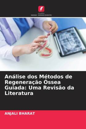 Análise dos Métodos de Regeneração Óssea Guiada: Uma Revisão da Literatura