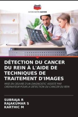 DÉTECTION DU CANCER DU REIN À L'AIDE DE TECHNIQUES DE TRAITEMENT D'IMAGES