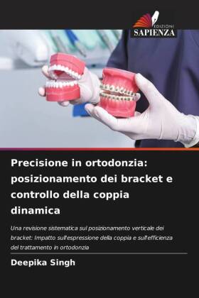 Precisione in ortodonzia: posizionamento dei bracket e controllo della coppia dinamica