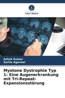 Myotone Dystrophie Typ 1: Eine Augenerkrankung mit Tri-Repeat-Expansionsstörung