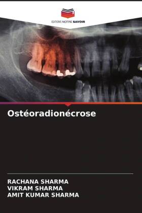 Ostéoradionécrose