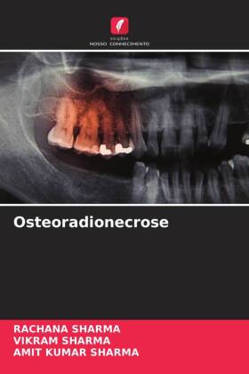 Osteoradionecrose