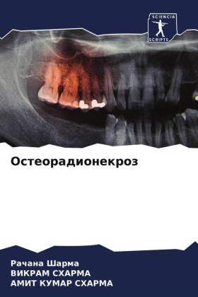 Osteoradionekroz