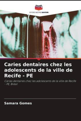 Caries dentaires chez les adolescents de la ville de Recife - PE