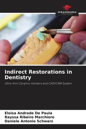 Indirect Restorations in Dentistry