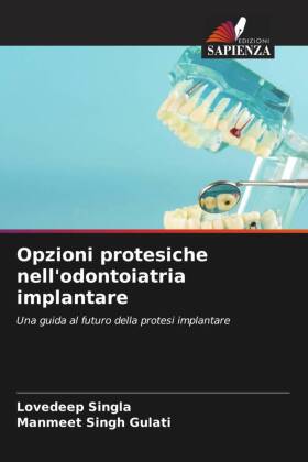 Opzioni protesiche nell'odontoiatria implantare