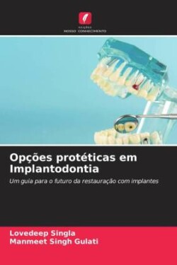 Opções protéticas em Implantodontia