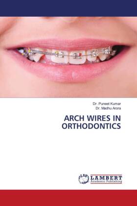 ARCH WIRES IN ORTHODONTICS