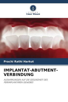 IMPLANTAT-ABUTMENT-VERBINDUNG